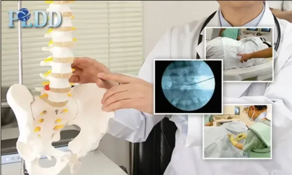 New advanced technology laser disc decompression Therapy - Image 2